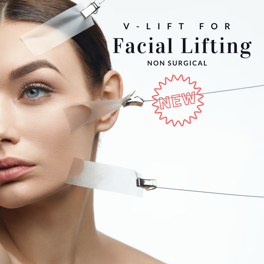 VLIFT Treatment that lifts sunken cheeks and droopy jowls! Lesprit