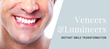 Veneers and lumenieers smile transformation