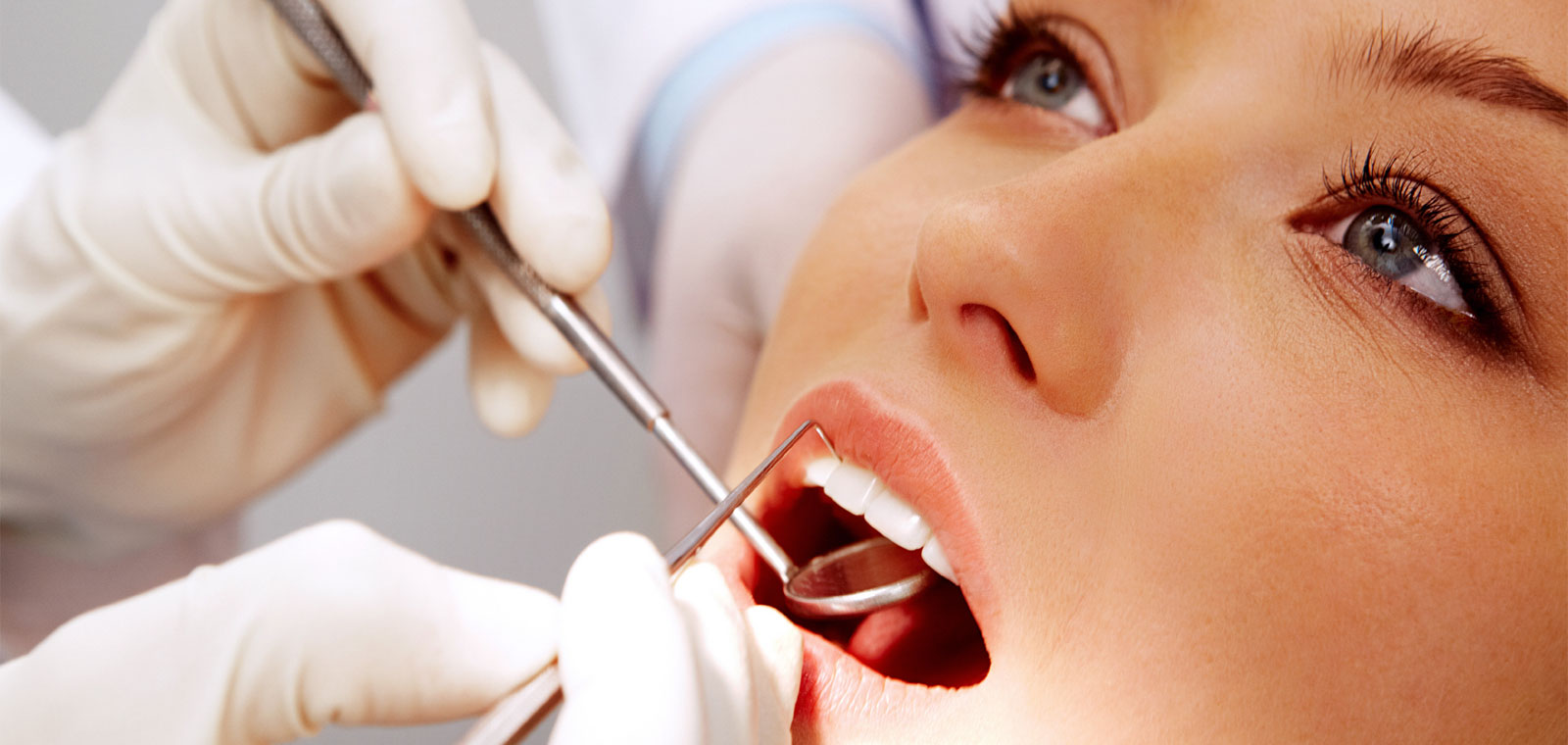 Dental Scaling and Polishing